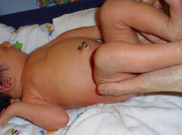 Neugeborenes ohne Geburtsschaden