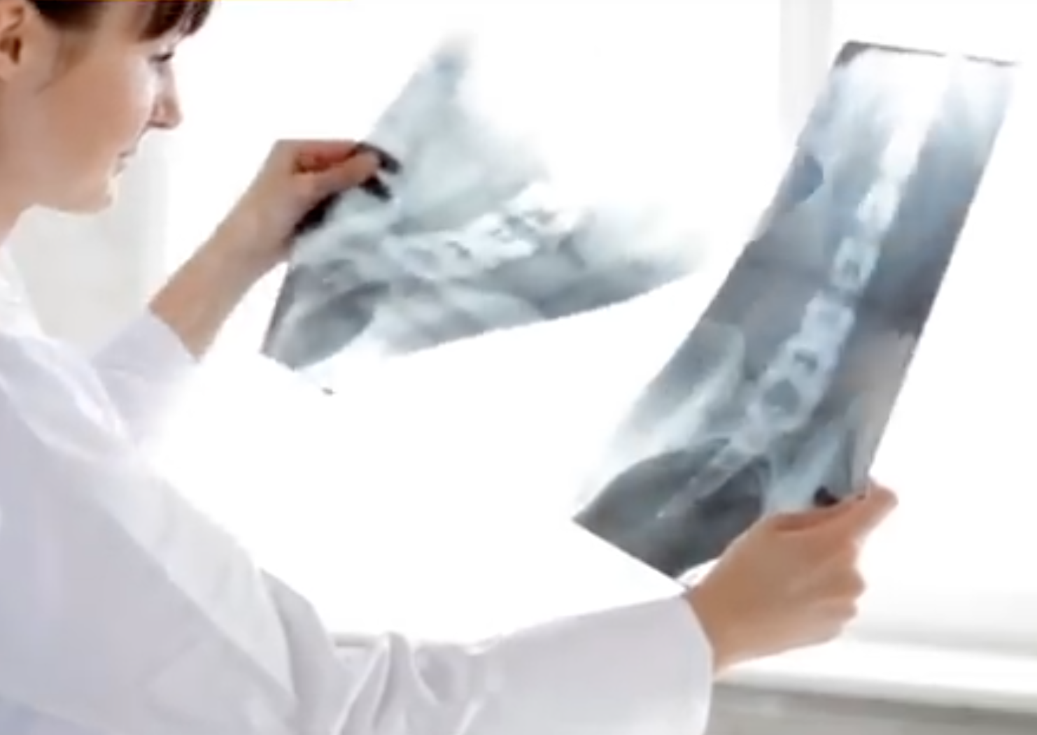 Radiologe betrachtet Röntgenaufnahmen