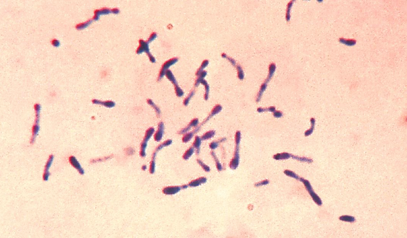 Diphterie Bakterien