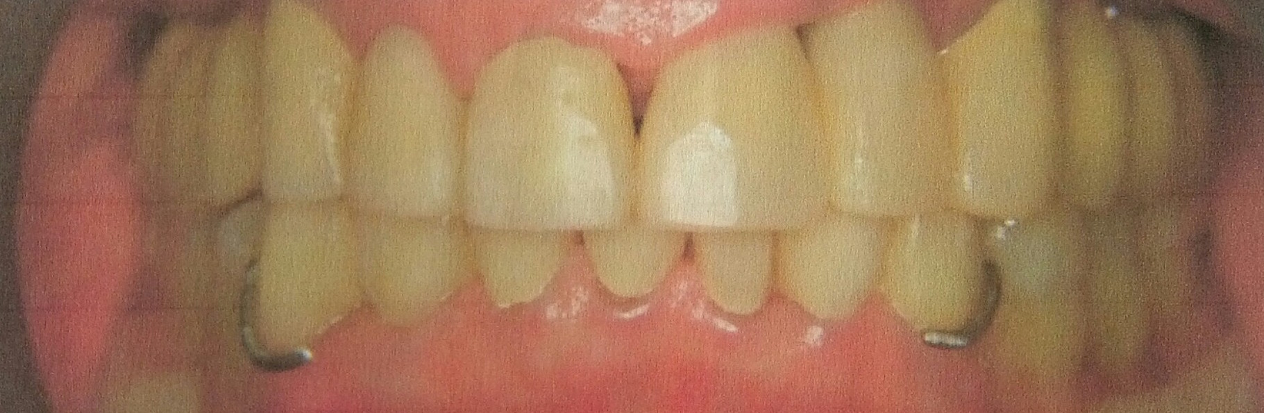 Zähne eines Patienten